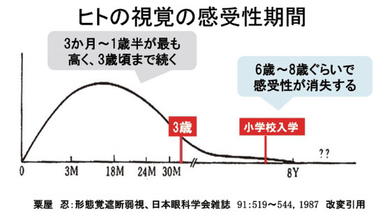 ヒトの視覚の感受性期間